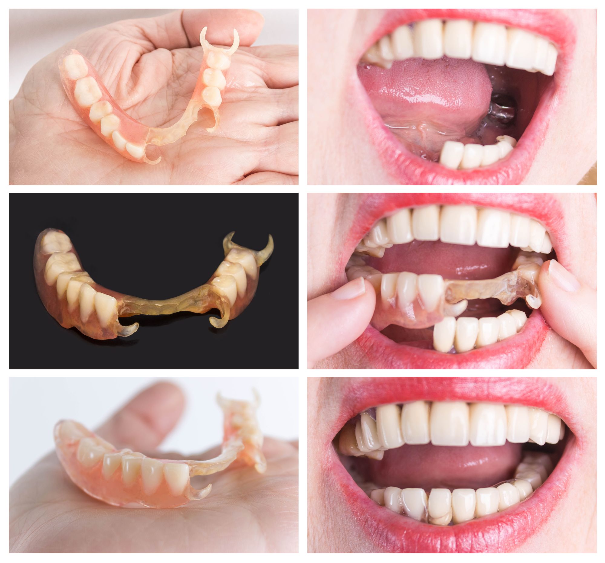 Image of partial dentures