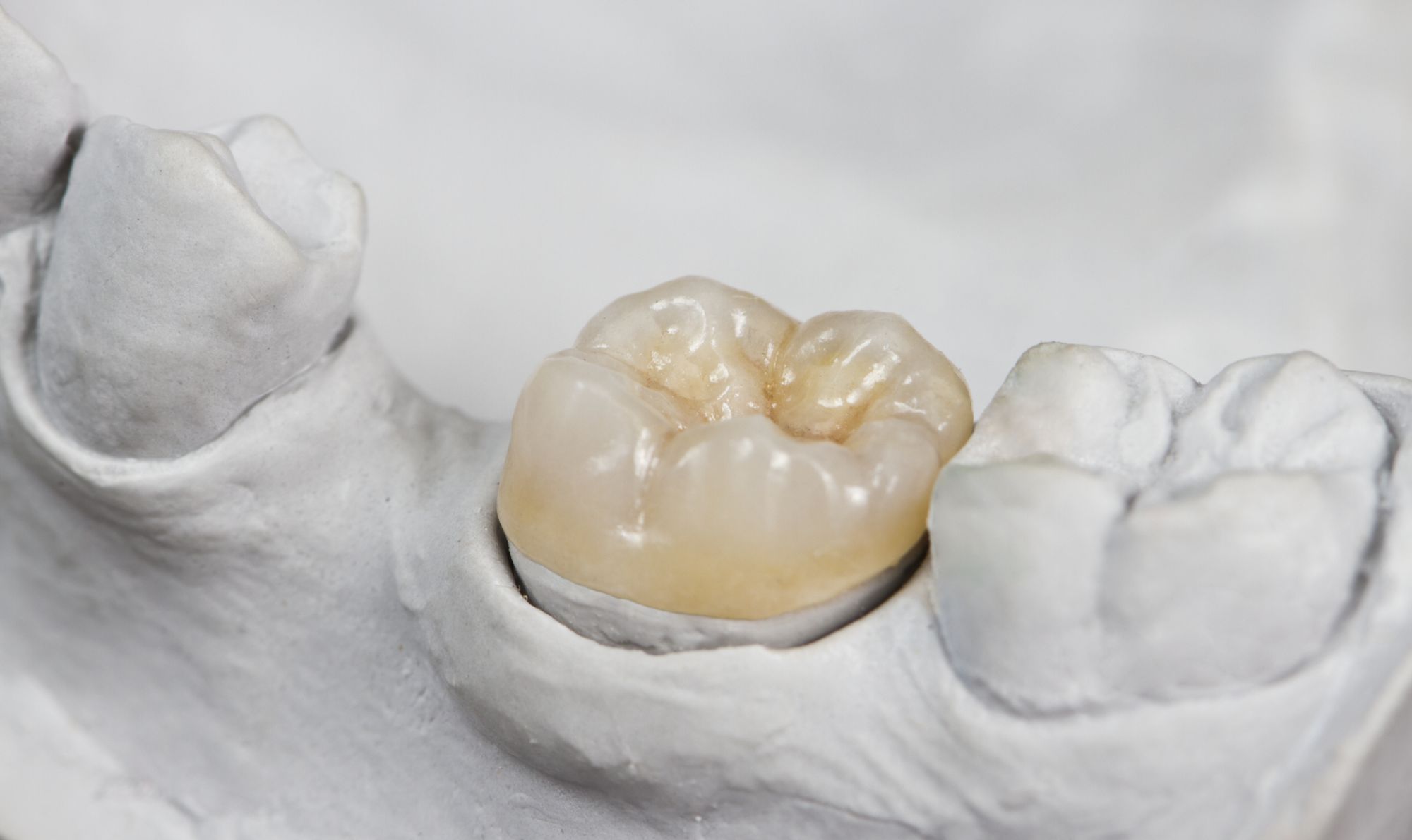 Image of tooth