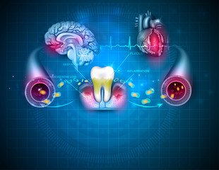 Image of factors in tooth loss